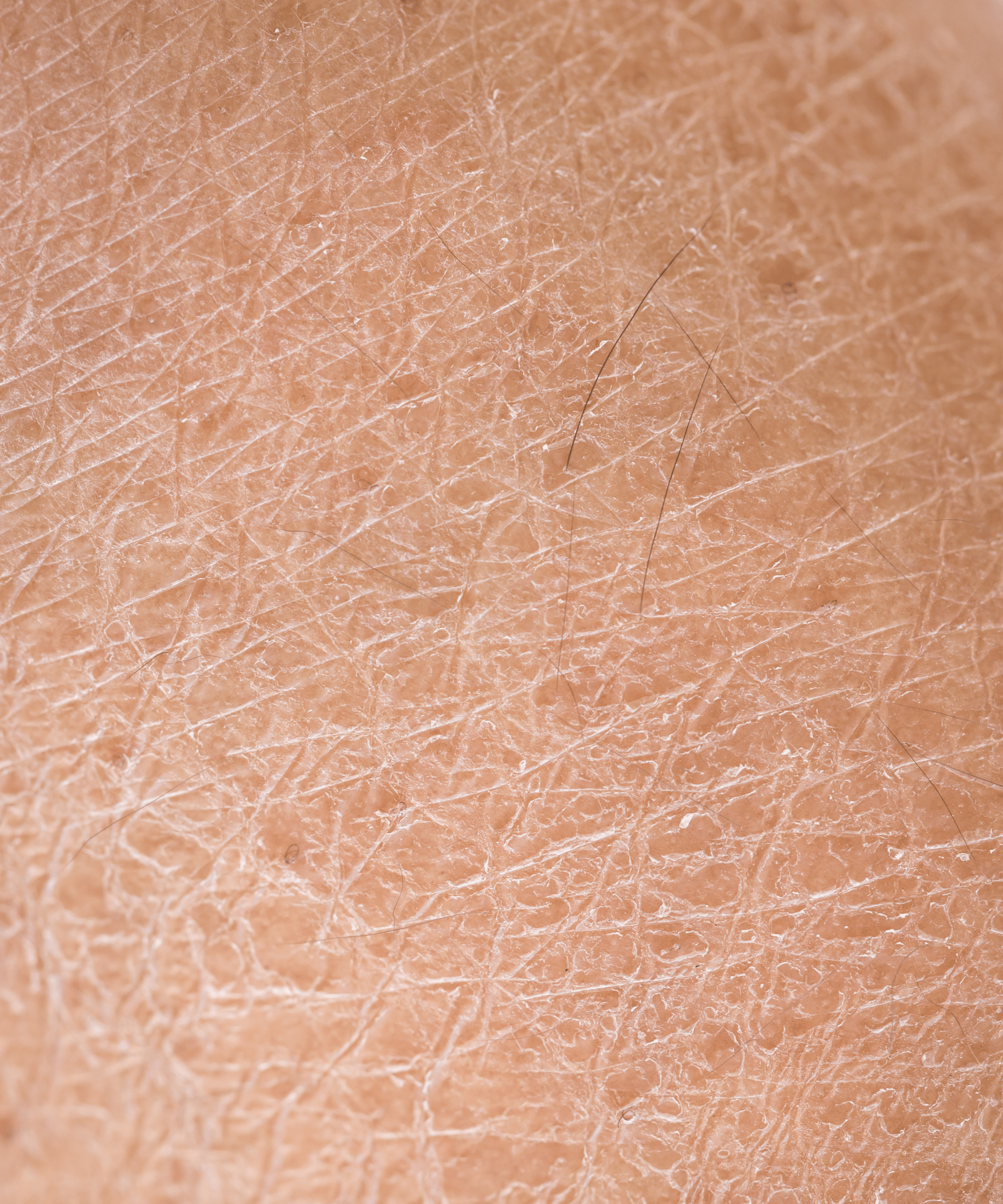 Dry & Mature Skin - Awear