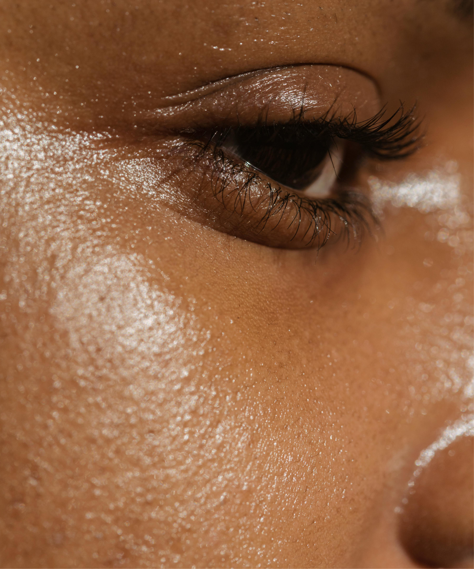 Oily & Blemish-Prone Skin