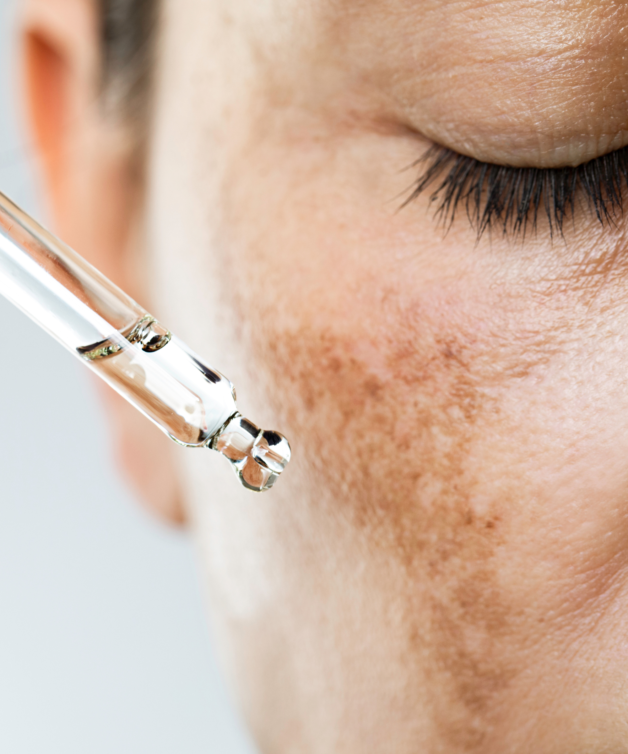 Dull & Uneven Skin Tone