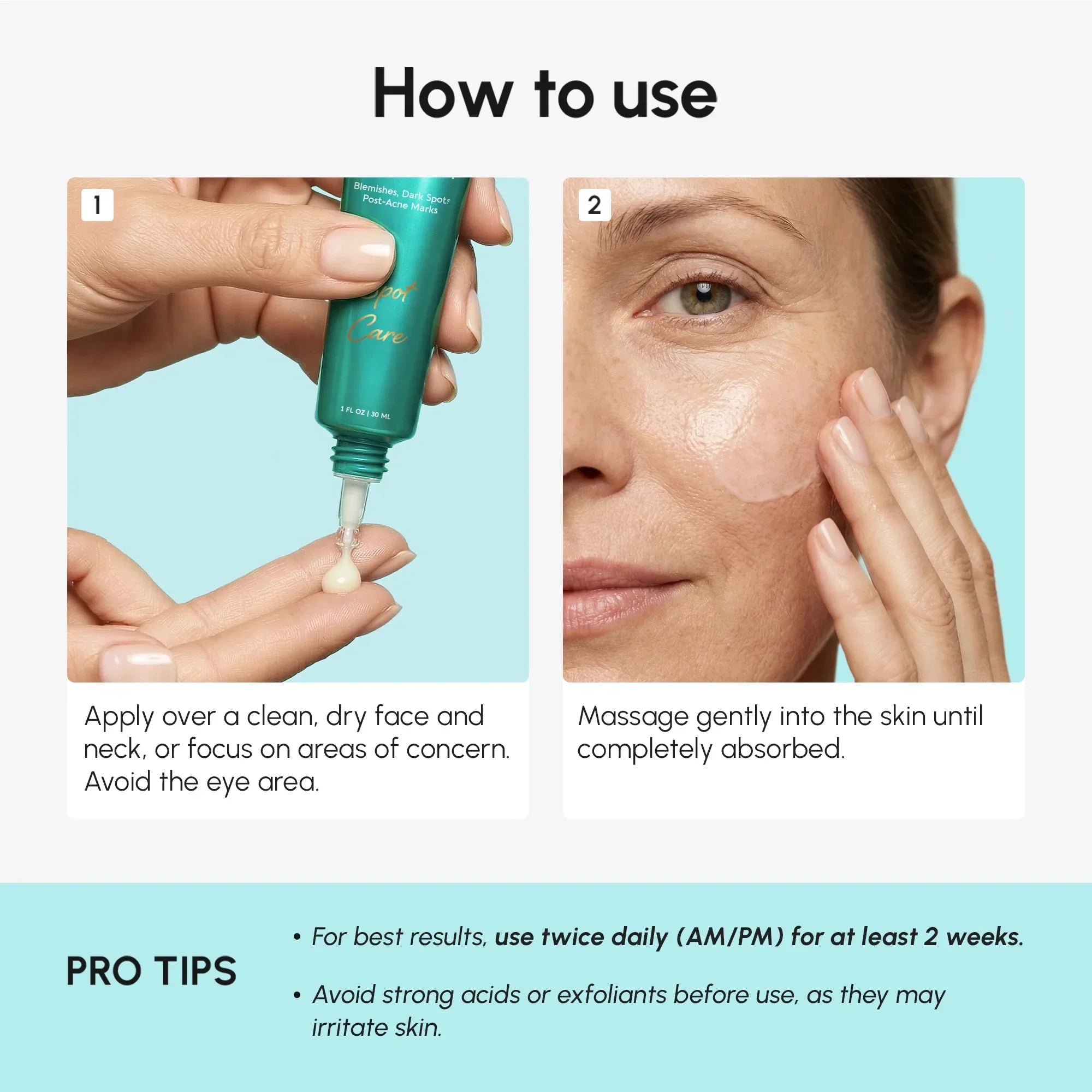 Azelaic Acid Cream