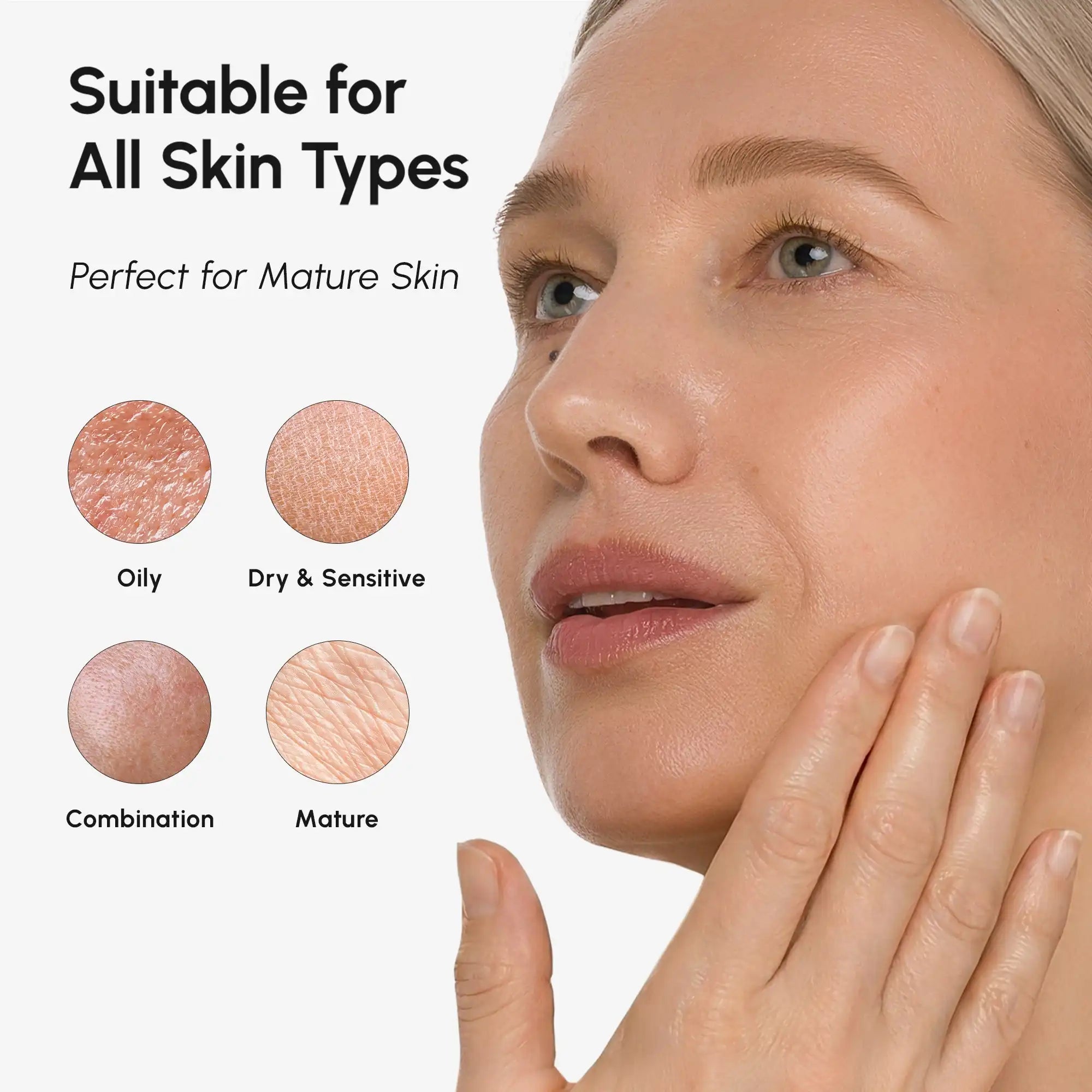 Azelaic Acid Cream